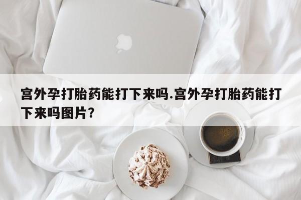 怀孕可以自己买药流吗宫外孕打胎药能打下来吗.宫外孕打胎药能打下来吗图片？